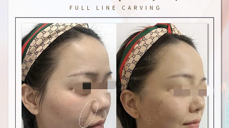 雅萌抗衰美容仪：揭秘其价格背后的科技与价值