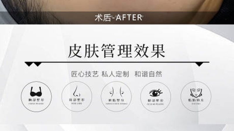 激光术后修复医用敷料：揭秘术后护理的守护者**