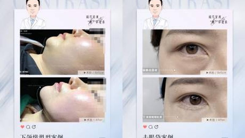 光子嫩肤术后，这些细节不能忽视**