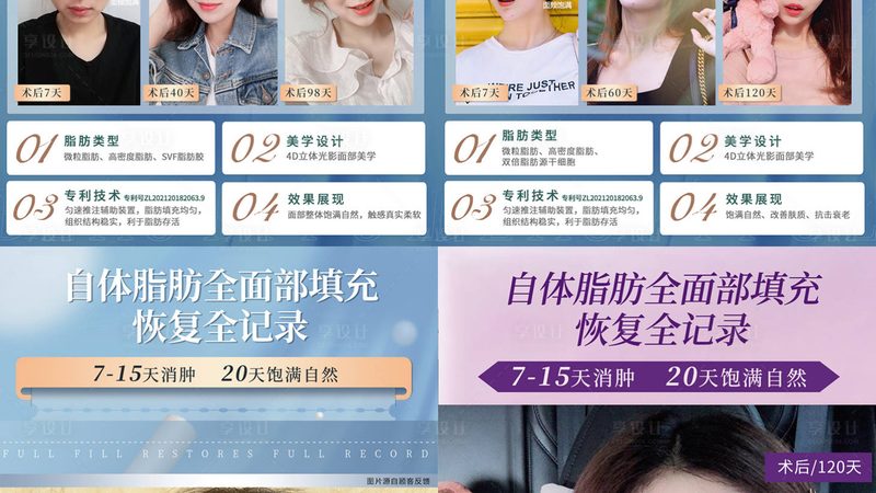 超声炮探头材质对效果影响