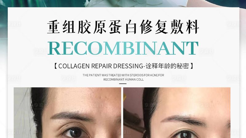 超声炮定制贴牌，是换壳还是真技术升级