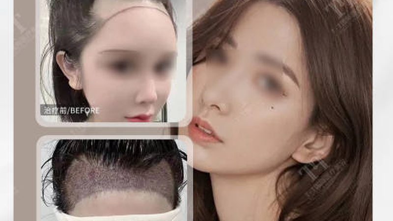 正规整形医院加盟需要哪些资质
