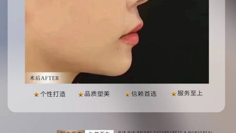 成都高端皮肤管理，收费标准背后的秘密