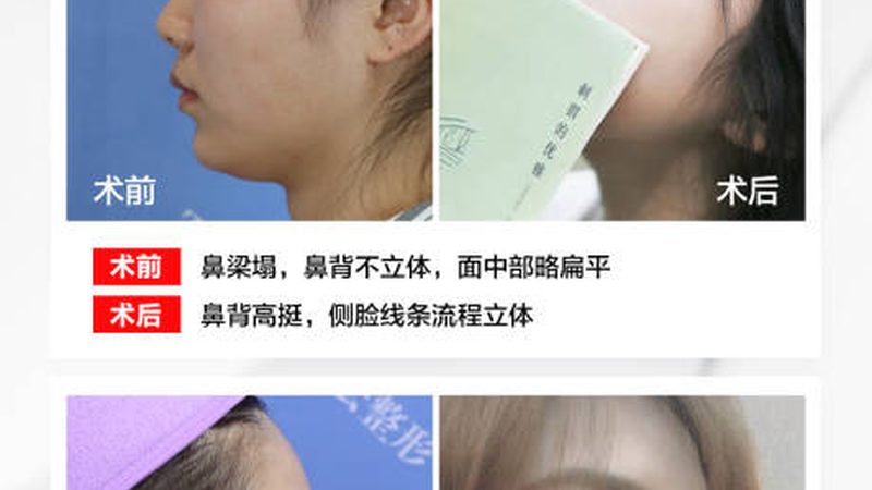 揭秘食品级玻尿酸：从原料到报价单的全方位解析