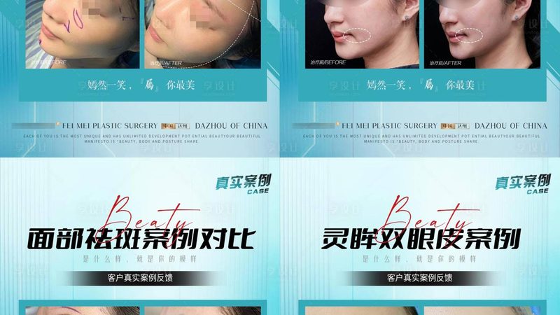 小标题：哺乳期，美容注射的隐忧