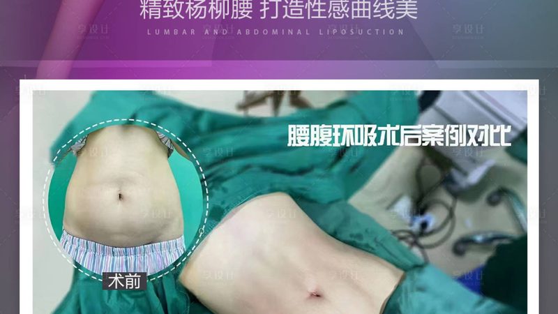 重庆面部轮廓整形恢复期揭秘：了解真实恢复过程