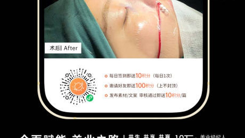 注射美容：哪些年龄群体需谨慎选择？**
