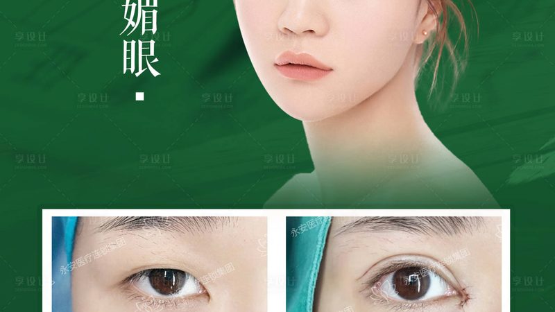 脂肪填充和线雕，抗衰思路完全不同