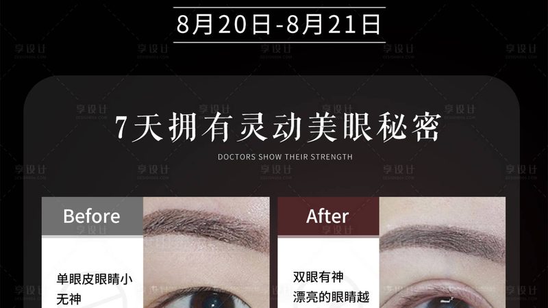 光子嫩肤仪功率参数，如何挑选最适合你的？**