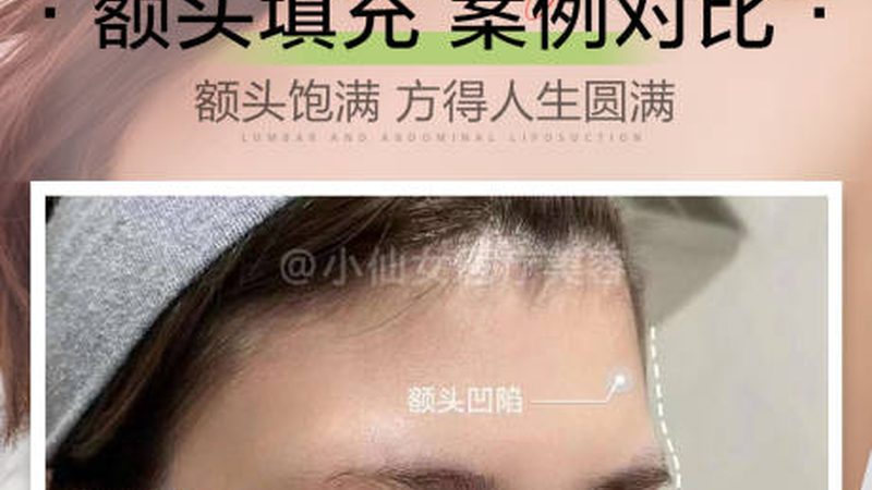 岁轻医美项目推荐