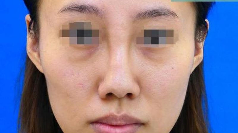 小标题：修复需求解析